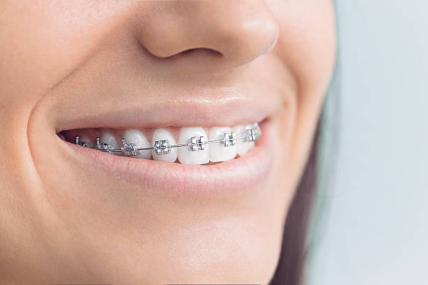 Best Traditional Braces  in Sandoval, IL